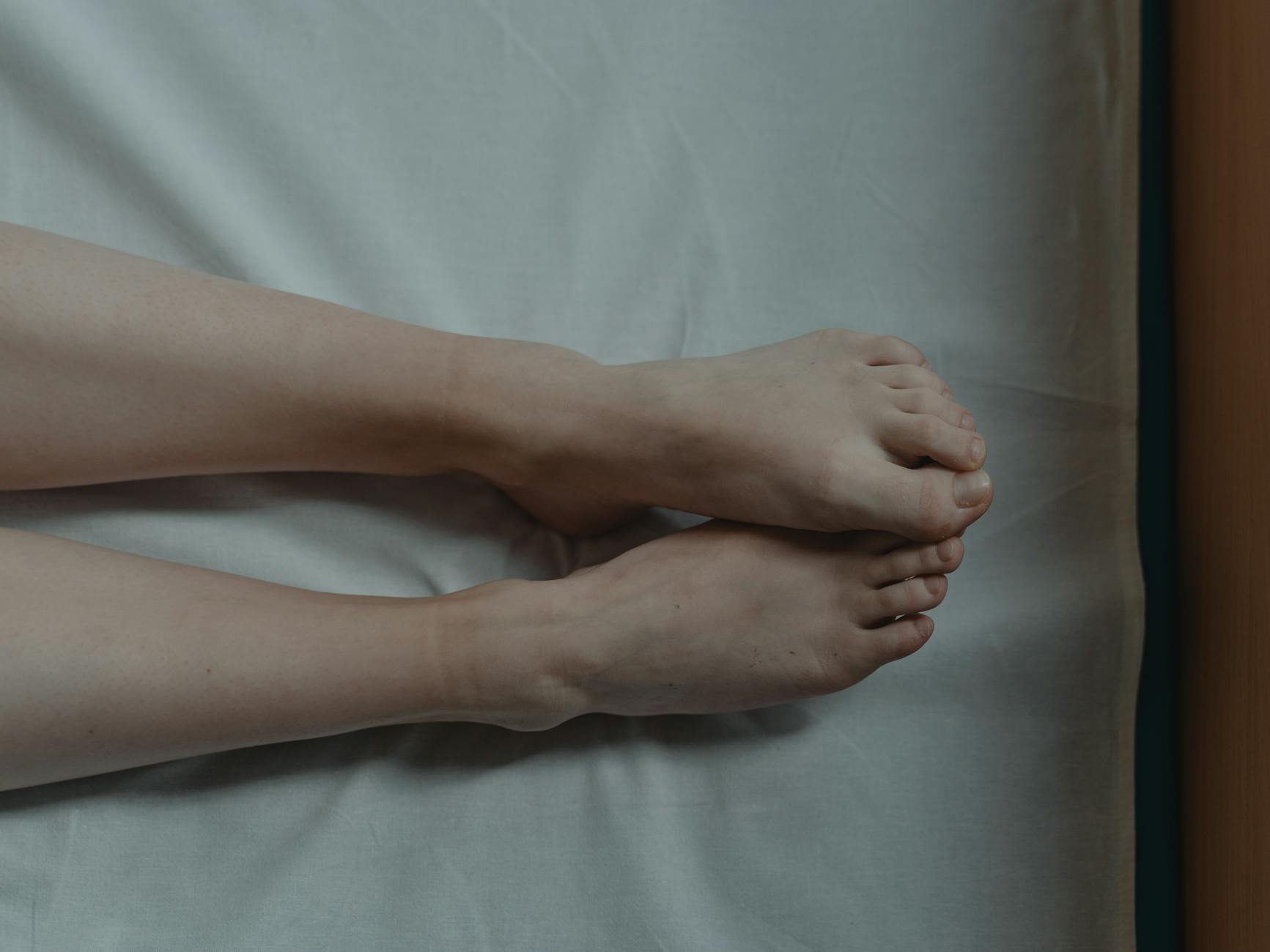 무좀 치료 약 바르는 라미실 효과 및 레이저 치료 실비 적용 팁 5 posttitle 1042