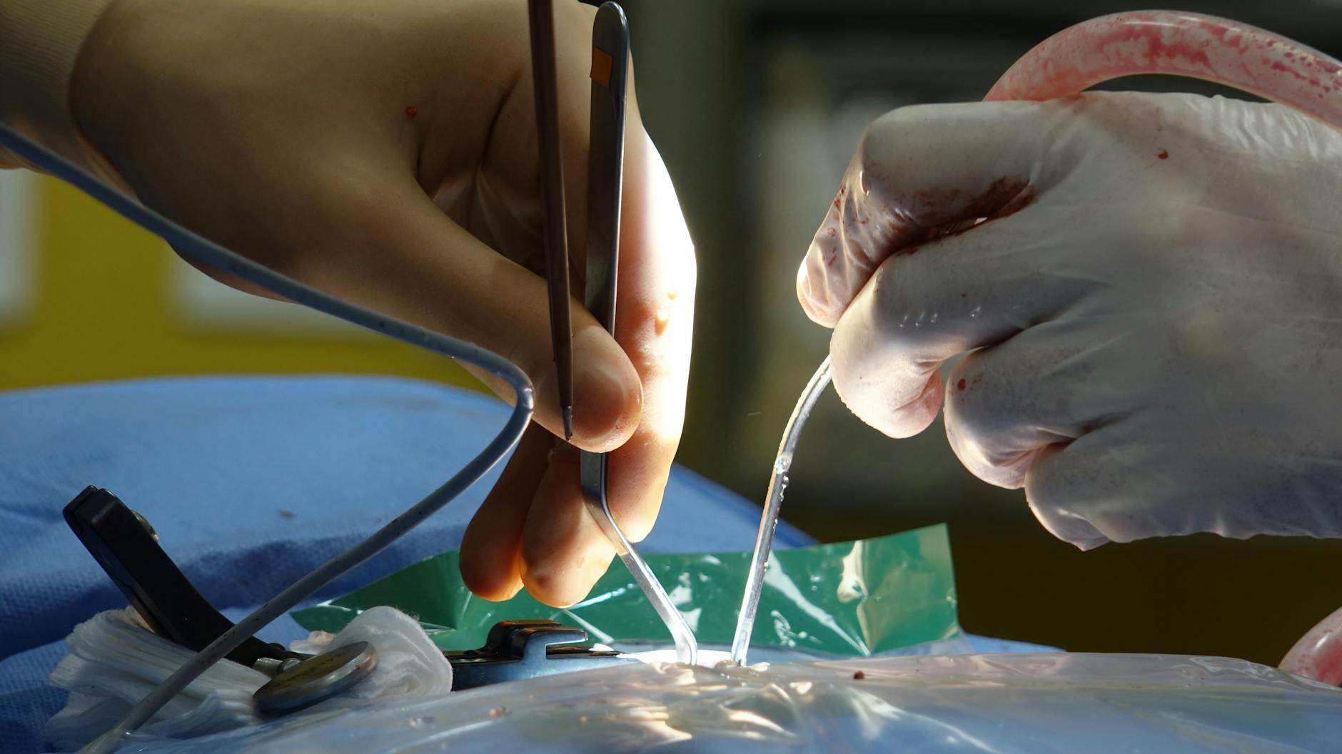 허리 디스크 신경차단술 비용 및 시술 후 운동 시작 시점 매뉴얼