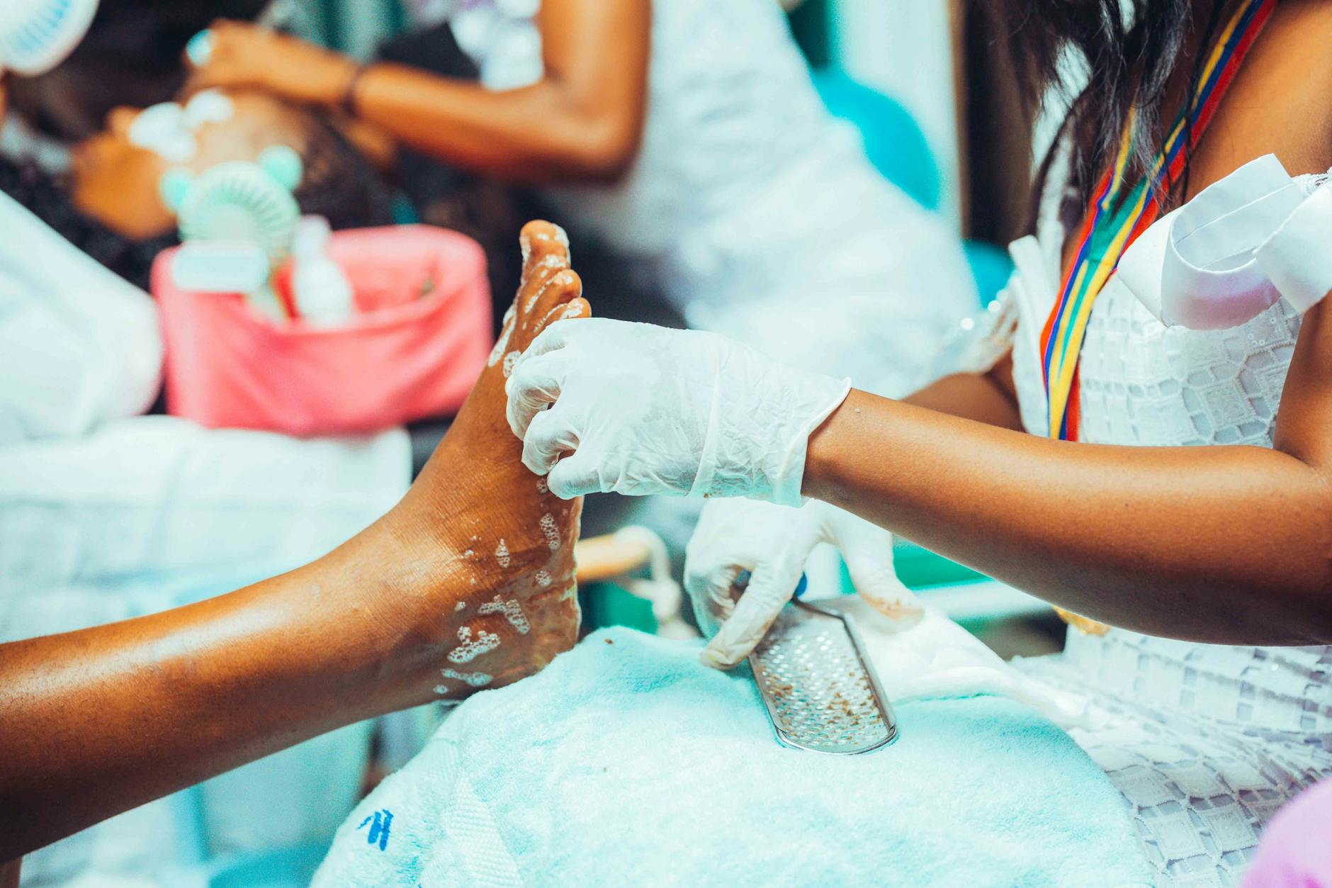 무좀 치료 약 바르는 라미실 효과 및 레이저 치료 실비 적용 팁